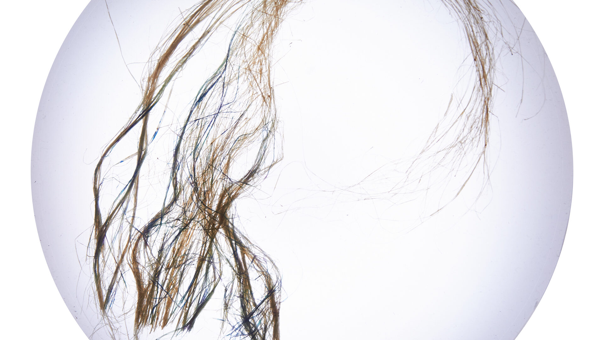 CRISPR – Anja Eilert project picture
